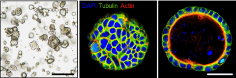 Zur Seite: 3D-Modelle in der Tumorforschung