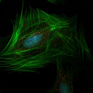 Microscopic images of nucleus and cytosceleton.