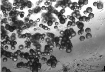 To the page:Sphäroid-Modelle für Gliome und Kopf-Hals-Tumoren