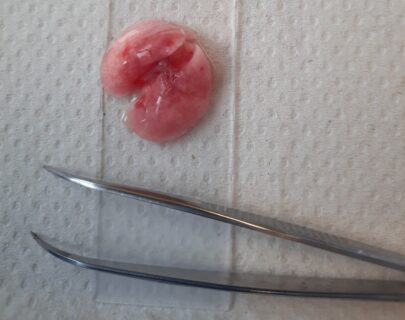 Die entnommene Lunge ist mit Agarose-Gel aufgefüllt worden, damit die Gewebestruktur gut erhalten bleibt.