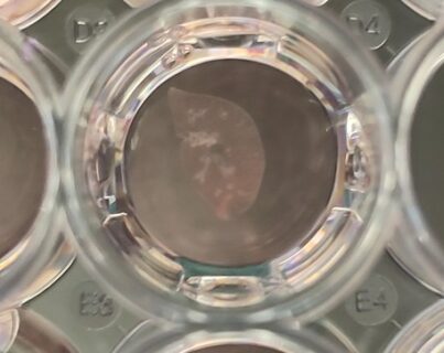 Gewebeschnitte der Lunge werden in Zellkulturplatten für mehrere Tage lebendig gehalten.