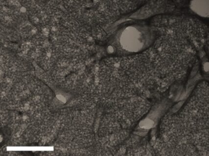 Unter dem Mikroskop kann man feststellen, dass in den Lungenschnitten die Gewebsstruktur während der Kultivierung erhalten bleibt.